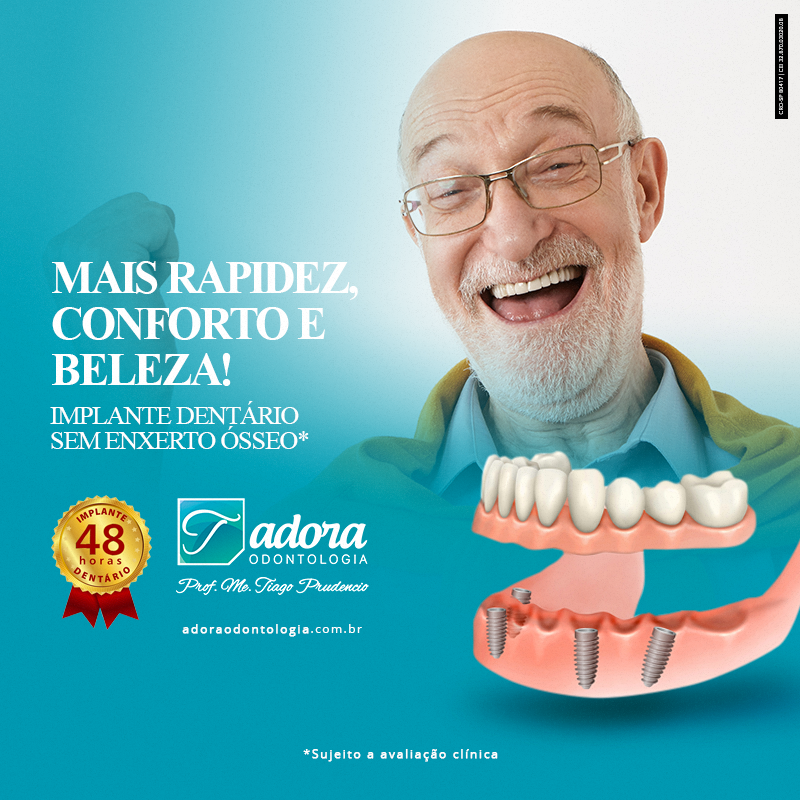 Implante dentário qual o valor