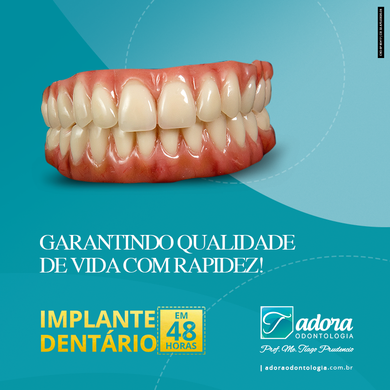 Implante dentário qual o valor