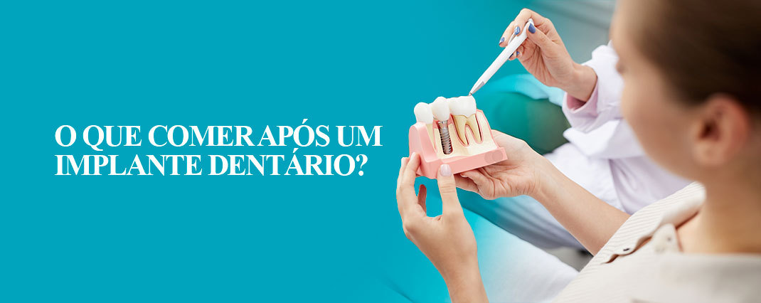 O que comer após um implante dentário?