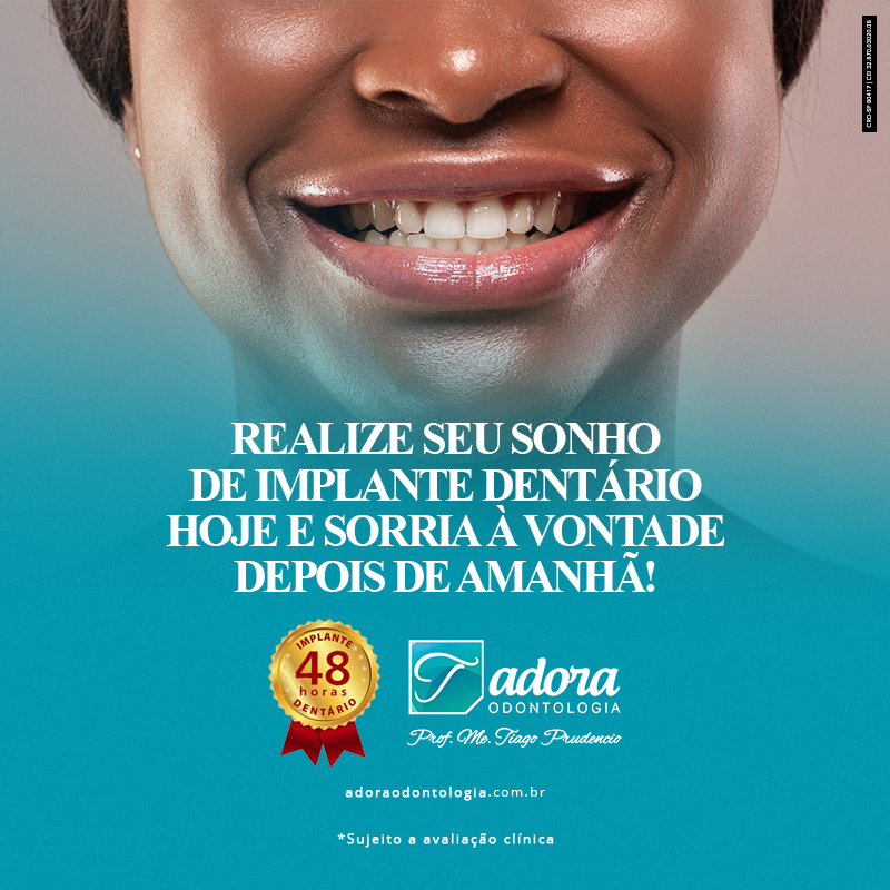 Adora Odontologia Realize seu sonho de implante dentário