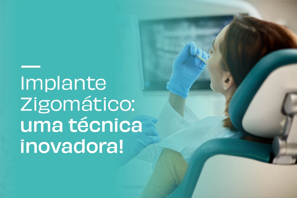 Implante Dentário São Carlos - Implante Zigomático